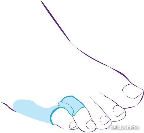 Межпальцевая перегородка Trives СТ-52.2 с протектором