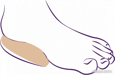 Комплект подпяточников ортопедических Trives С амортизатором СТ-233 (S)