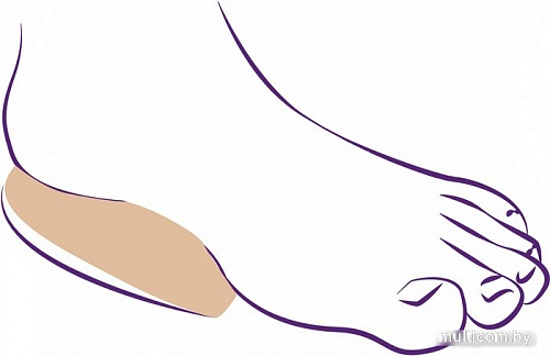 Комплект подпяточников ортопедических Trives С амортизатором СТ-233 (XL)