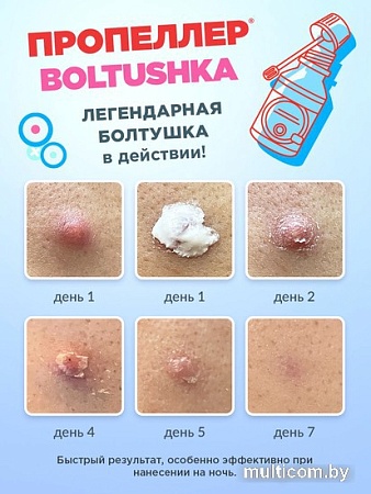 ПРОПЕЛЛЕР Лосьон для лица Boltushka салициловый от прыщей для локального нанесения (25 мл)
